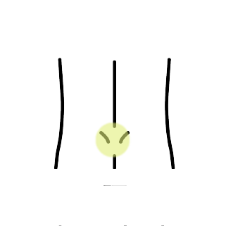 腰痛・ぎっくり腰・腰椎椎間板ヘルニア